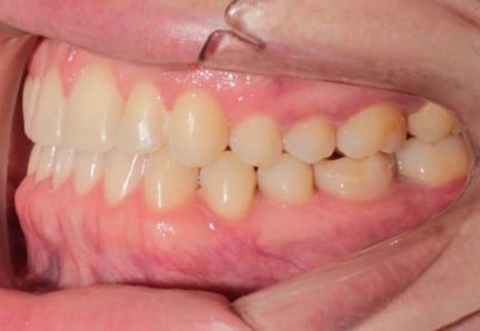 1102_photo_final_left-432x298