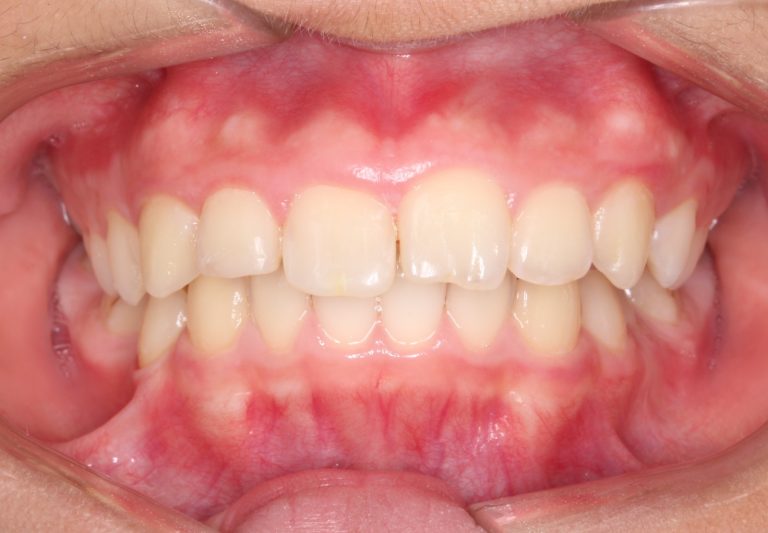 1216_photo_initial_front-768x533-1 1216_photo_initial_front-768x533-1