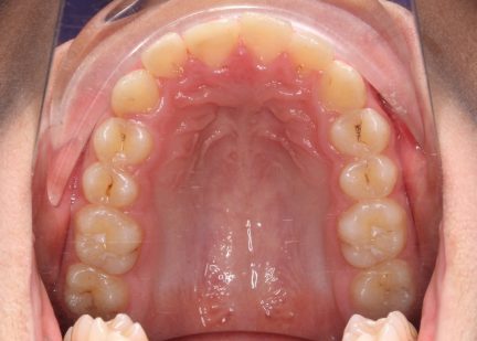 1216_photo_initial_upper-432x309