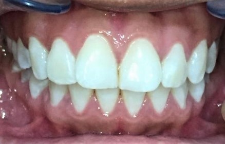 1250_photo_initial_front 1250_photo_initial_front