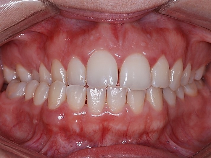 638_photo_initial_front 638_photo_initial_front