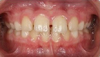 case2 - main image861_photo_initial_front case2 - main image861_photo_initial_front